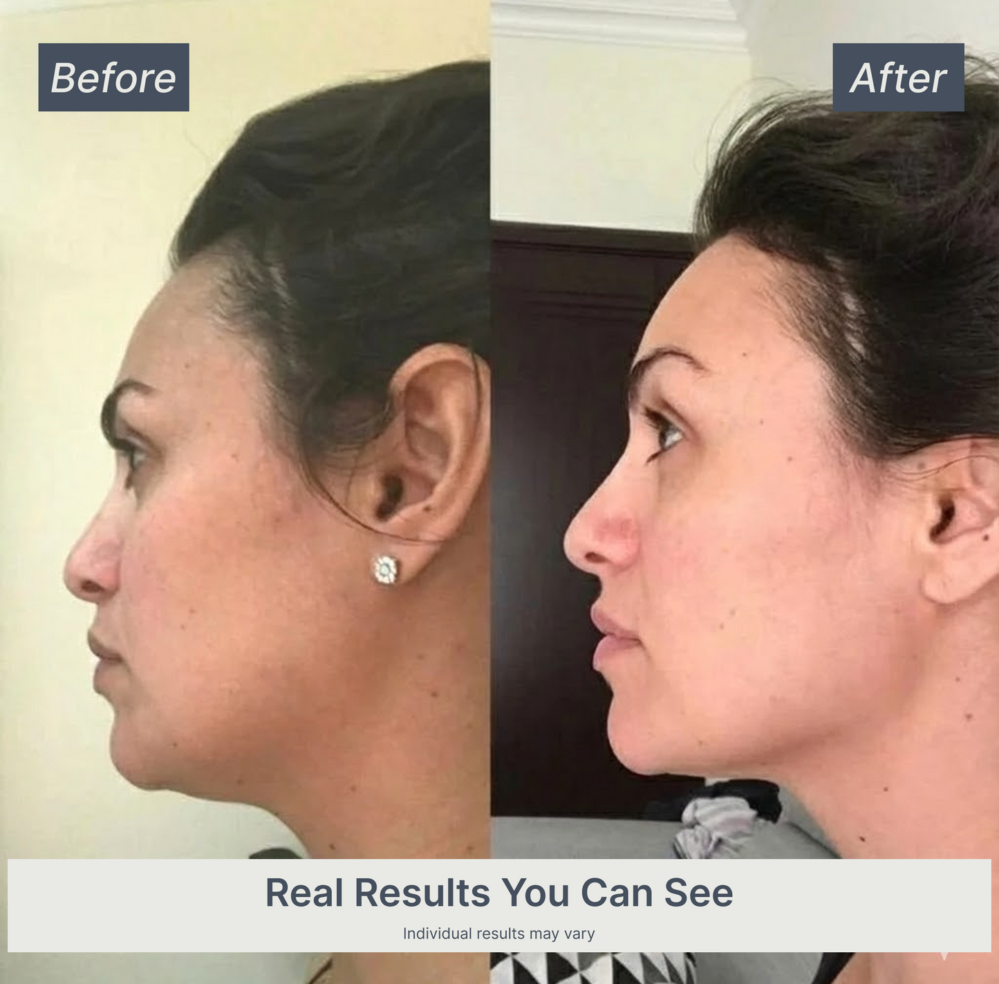 Vellivon Lymphatic Contour Brush