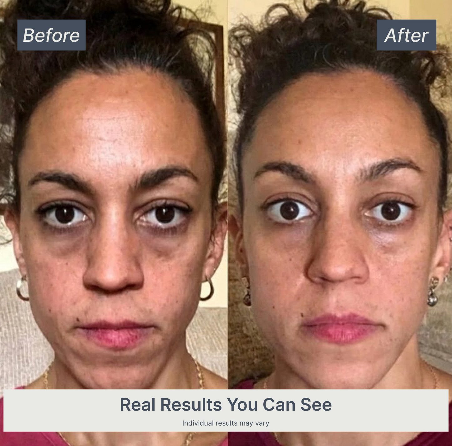 Vellivon Lymphatic Contour Brush