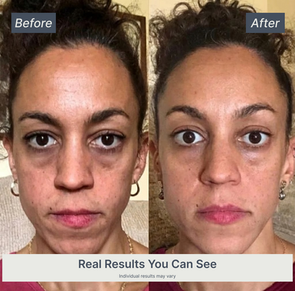 Vellivon Lymphatic Contour Brush