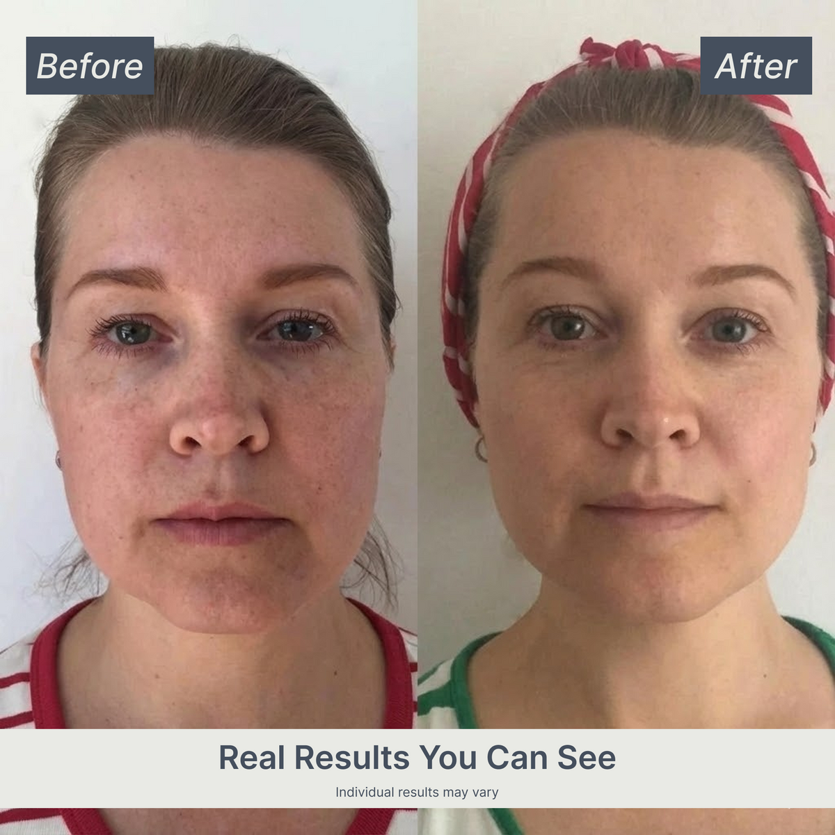 Vellivon Lymphatic Contour Brush